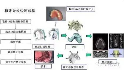 种植牙历史_种植牙历史_种牙的历史有多久