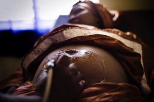 非洲女孩割礼残忍血腥 切除阴蒂阴唇难逃割礼厄运